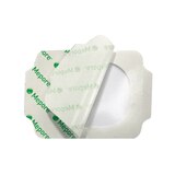 Molnlycke Health Care Mepore Self-adhesive Transparent Film Dressing 2-2/5 x 2-3/5 in., 100CT, thumbnail image 1 of 1